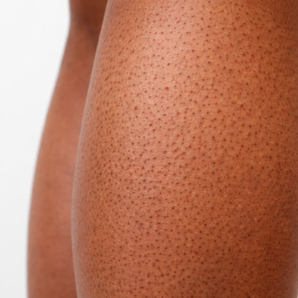 strawberry legs