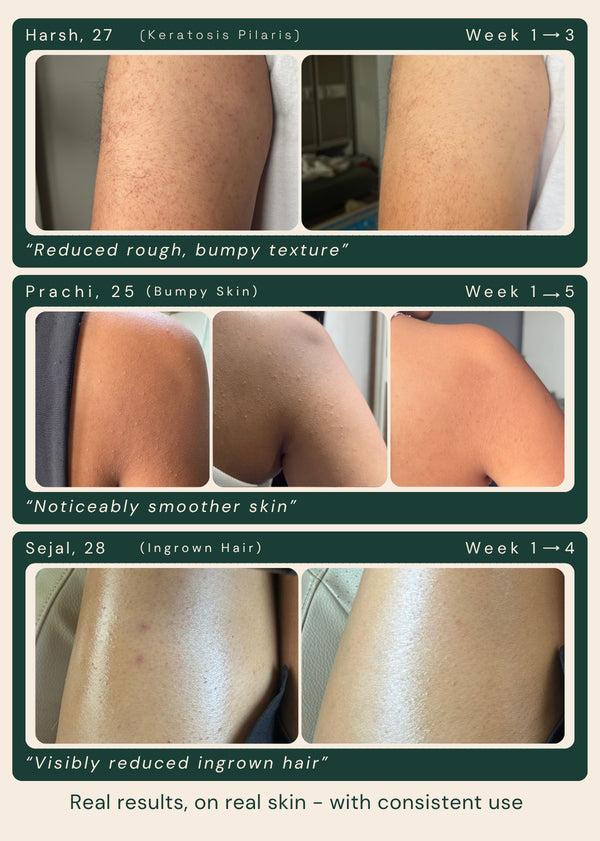 Triple Action Exfoliating Mist