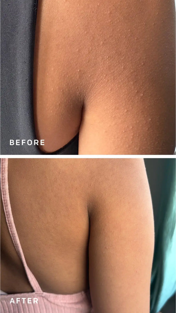 Triple Action Exfoliating Mist