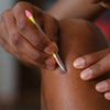 Ingrown hair