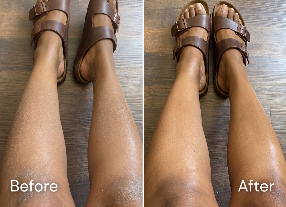Before and after skincare result