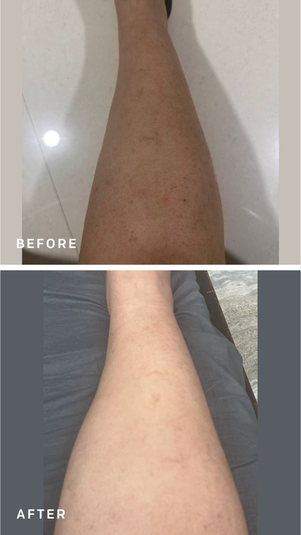 Triple Action Exfoliating Mist