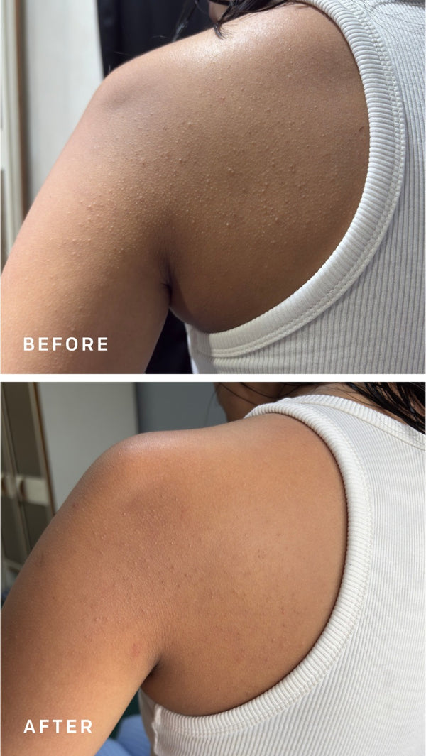 Triple Action Exfoliating Mist